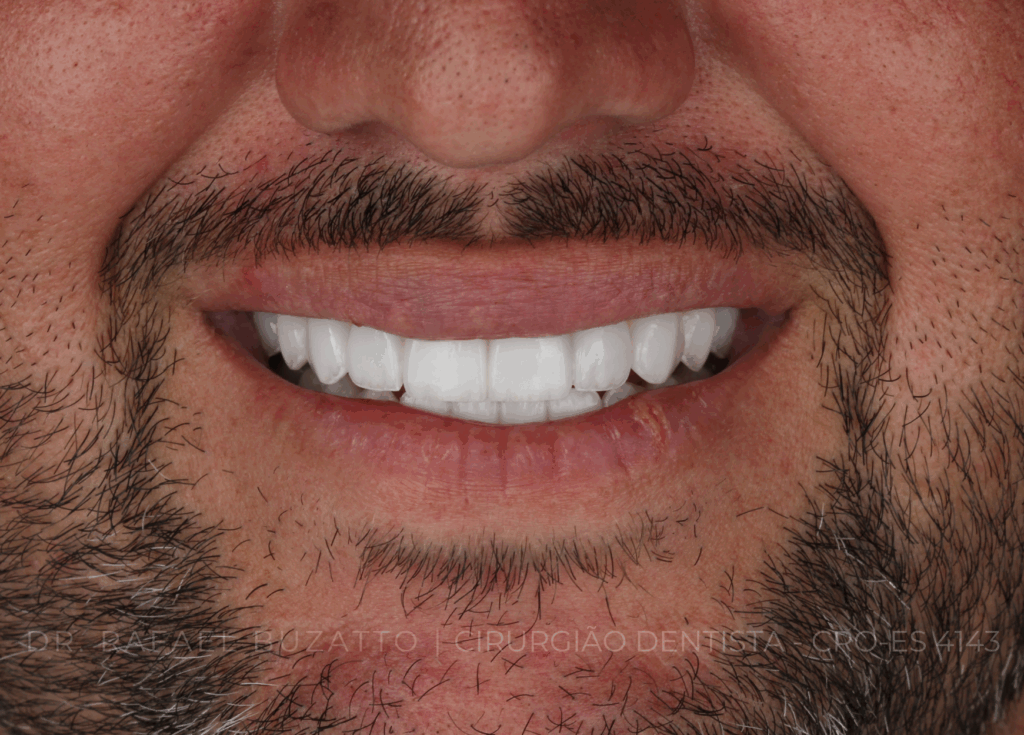 dentista rafael buzatto - 01