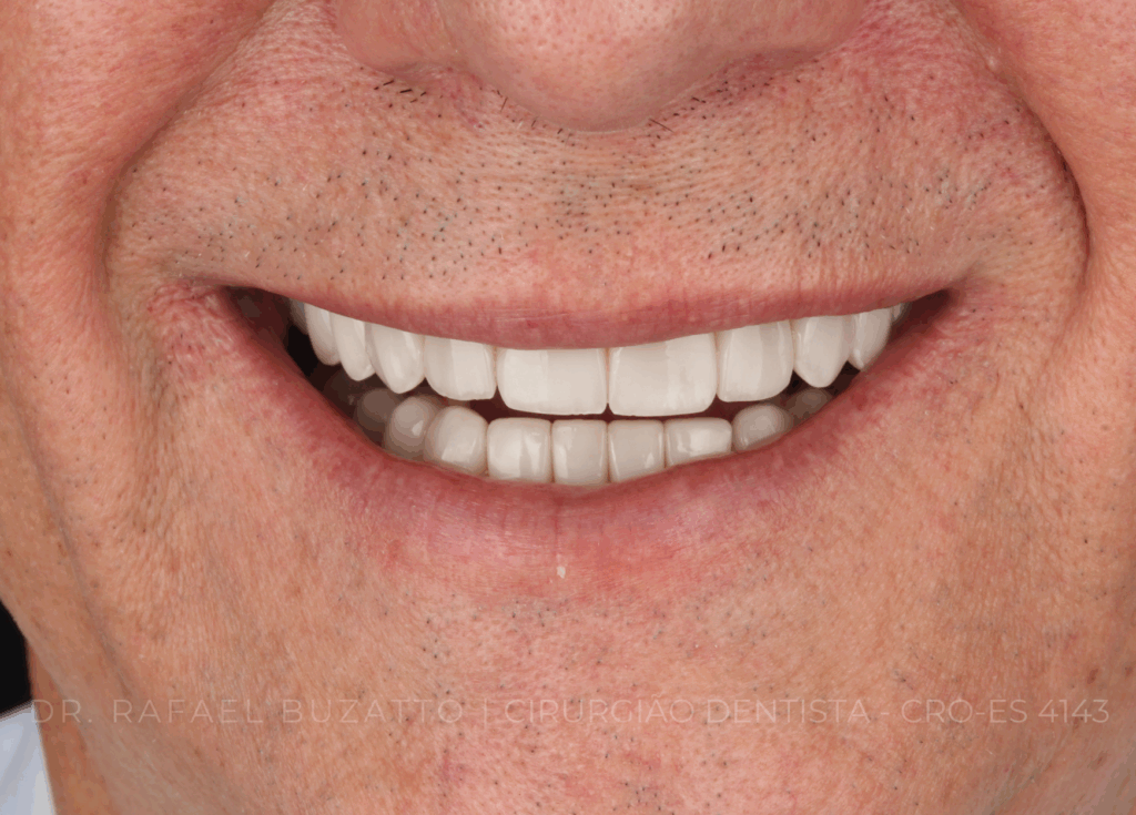 dentista rafael buzatto - 02