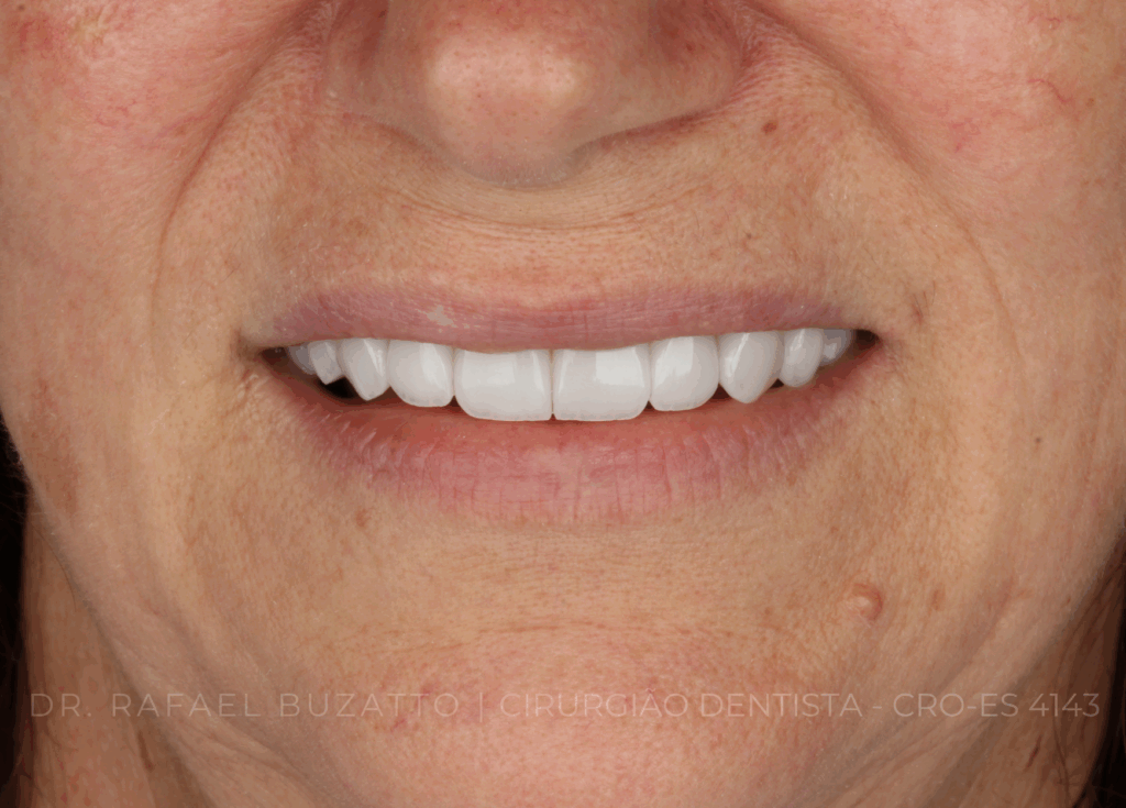 dentista rafael buzatto - 03