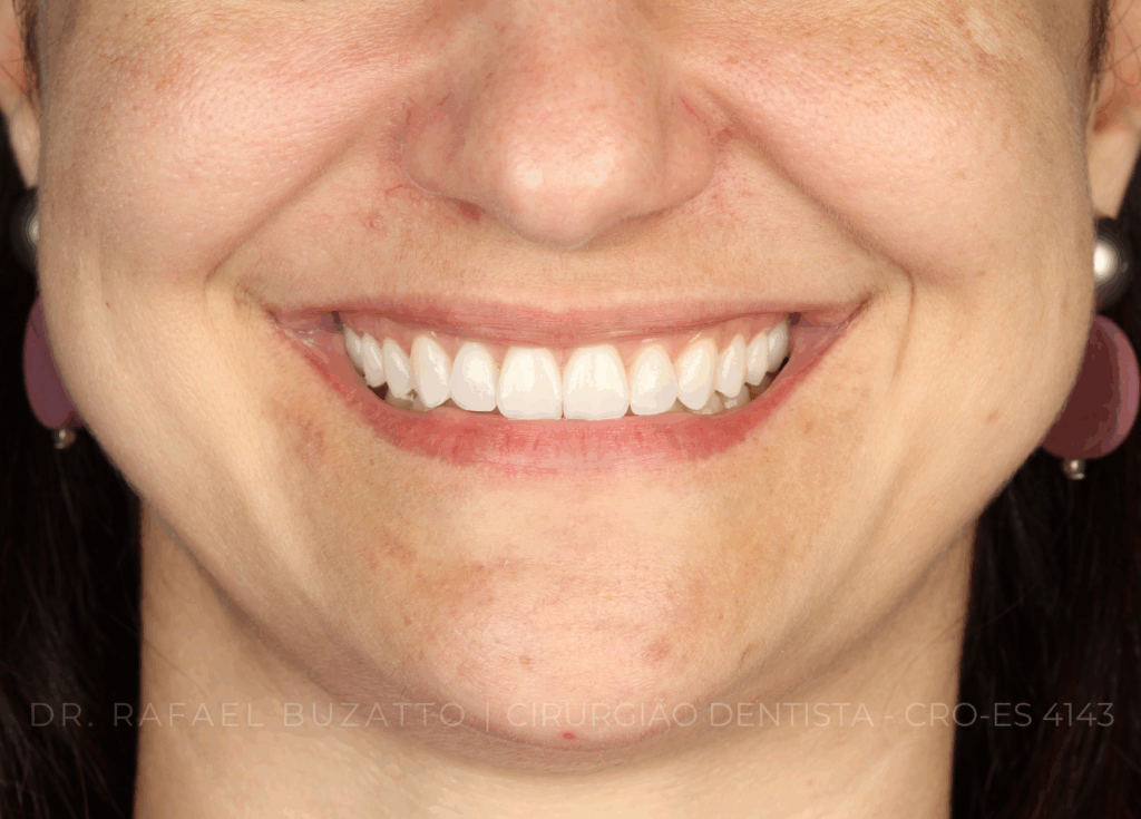 dentista rafael buzatto - 04