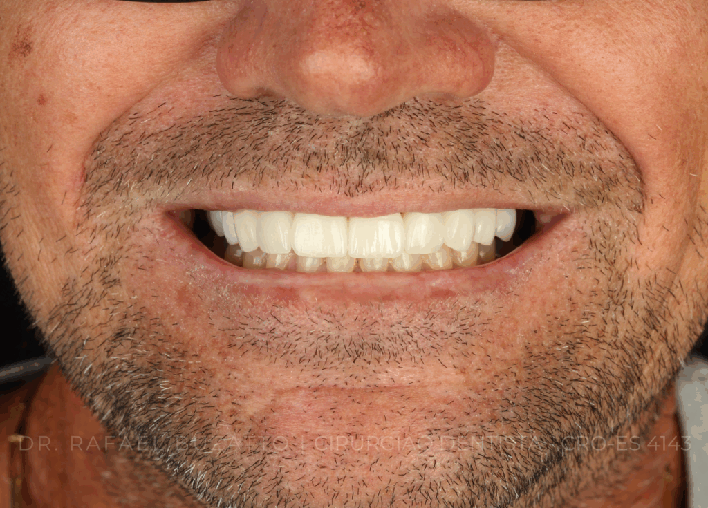 dentista rafael buzatto - 05