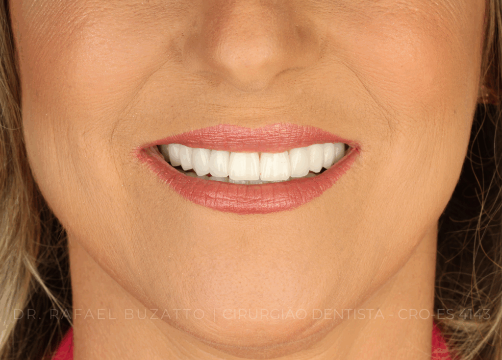 dentista rafael buzatto - 06