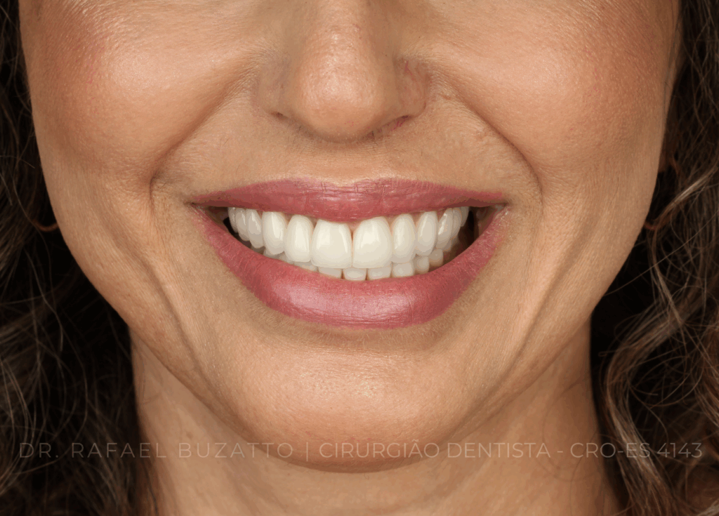 dentista rafael buzatto - 07