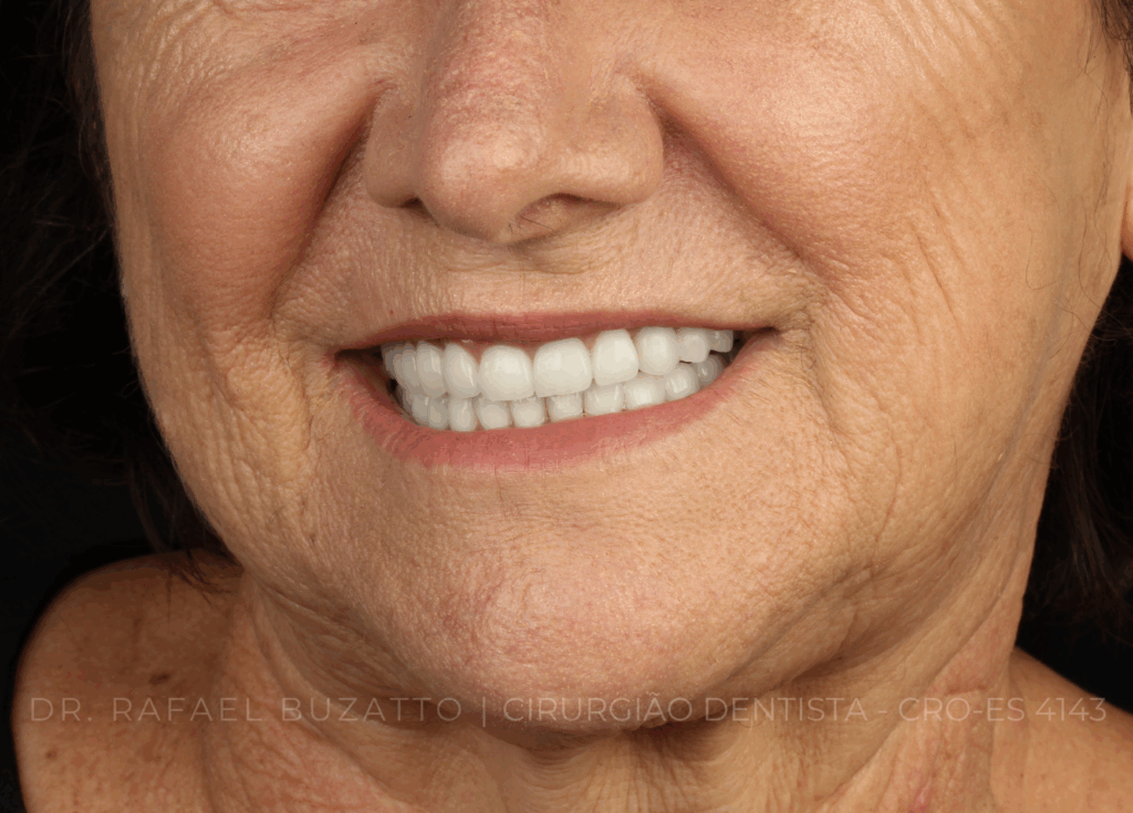dentista rafael buzatto - 10