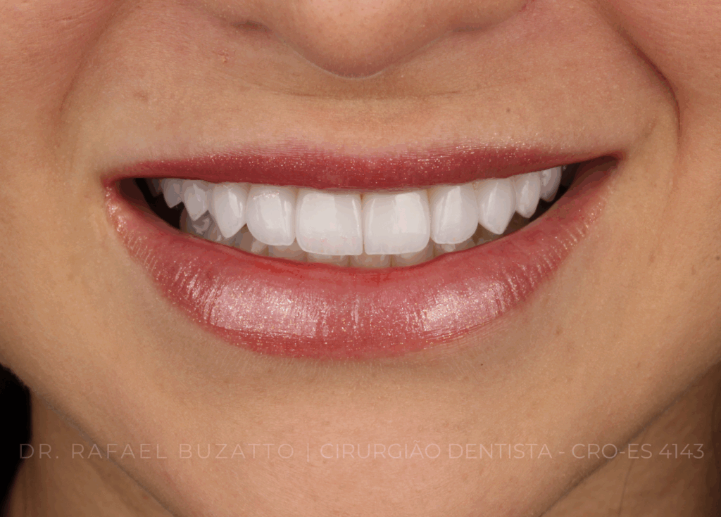 dentista rafael buzatto - 12