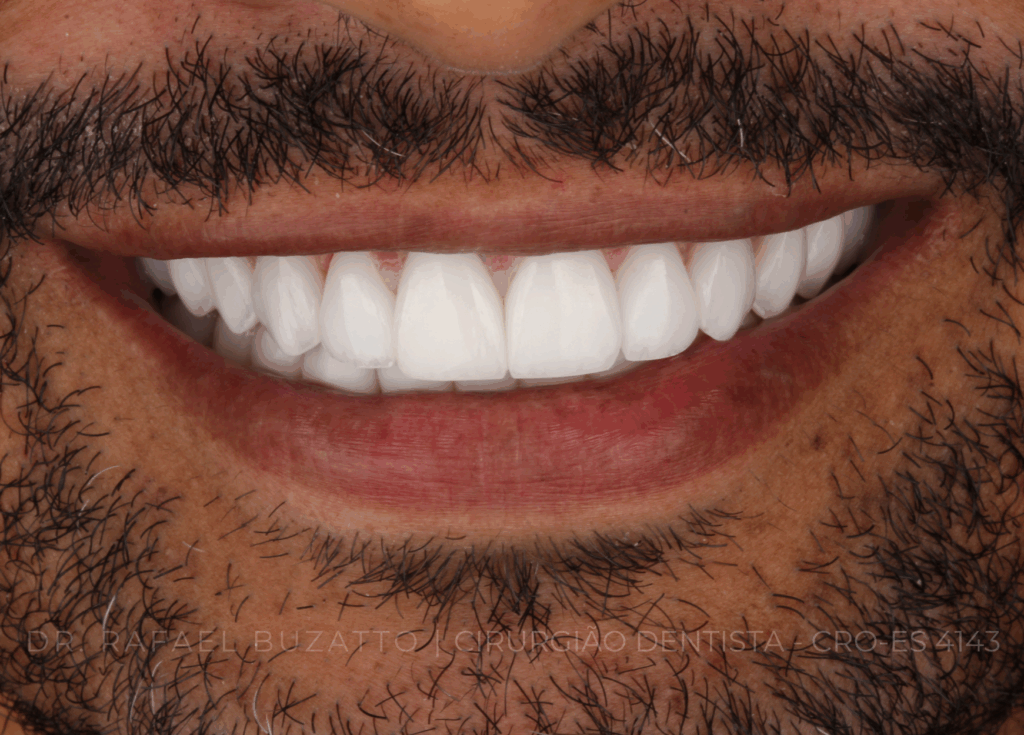 dentista rafael buzatto - 13