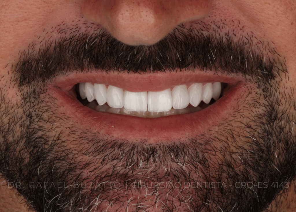 dentista rafael buzatto - 14